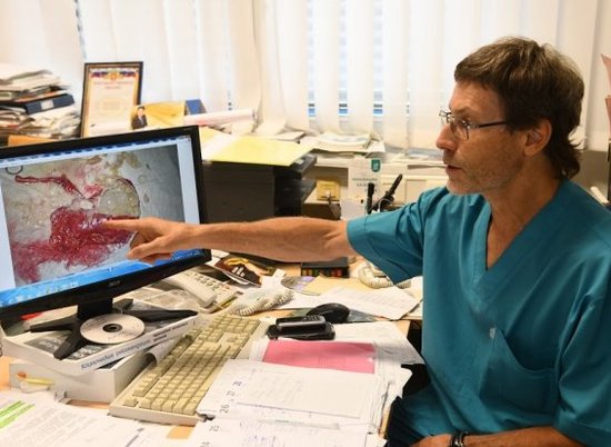 Волгоградские врачи провели уникальную операцию по удалению паразитов из почки